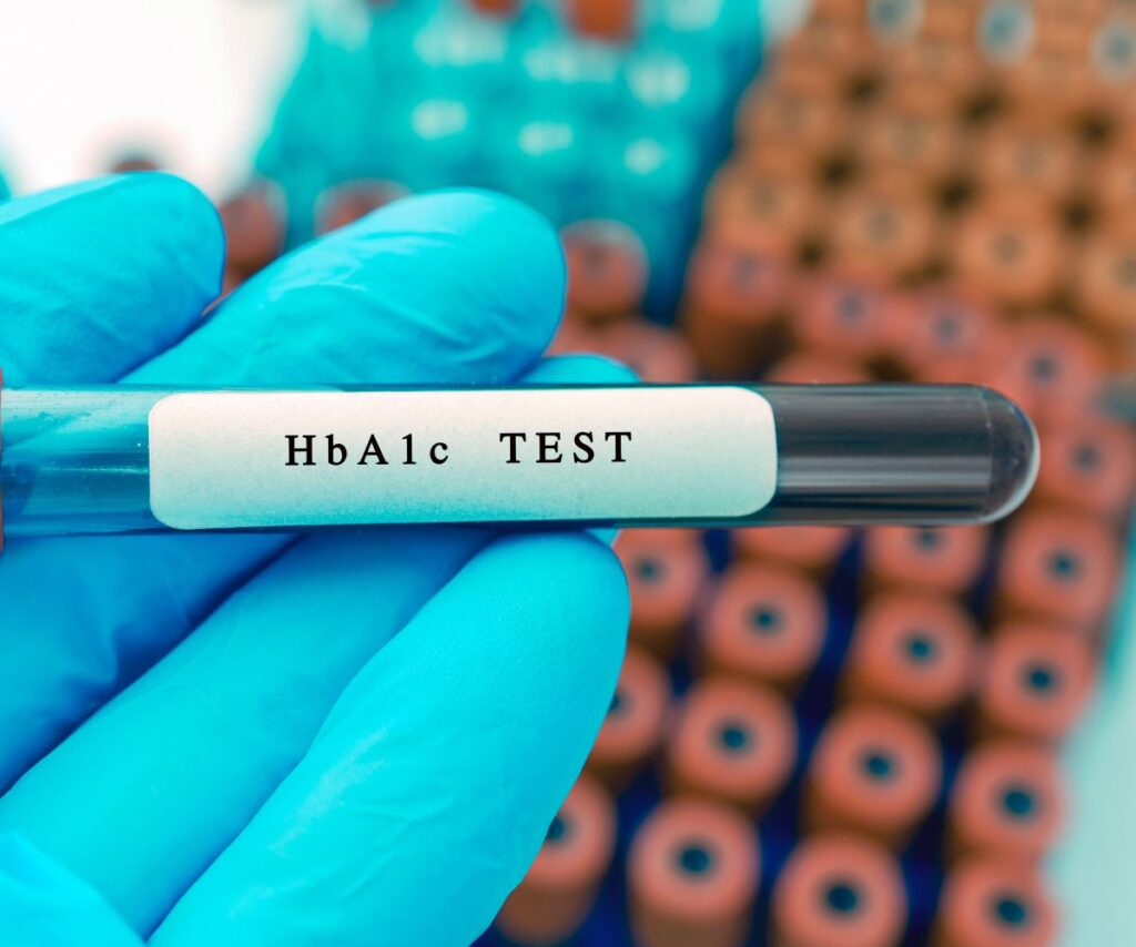 gloved hand holds a vile of blood for an HbA1c test