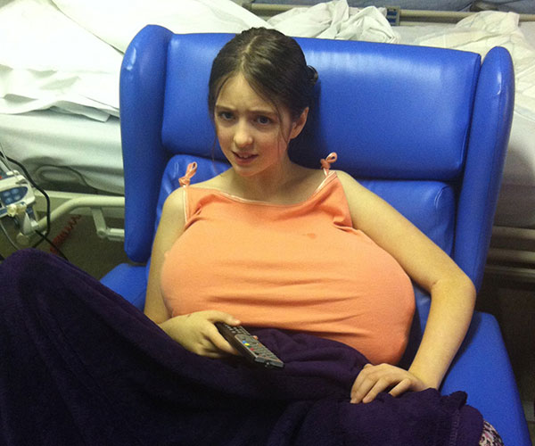 Real life story: “My 10-year-old has size J breasts”