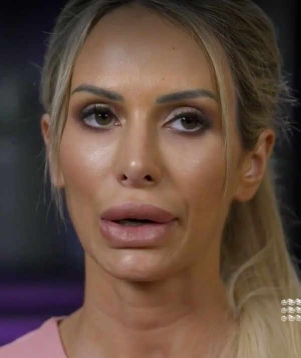 Married At First Sight 2020: Stacey's nose job shock